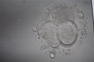 Embrion dividido en 4 D3